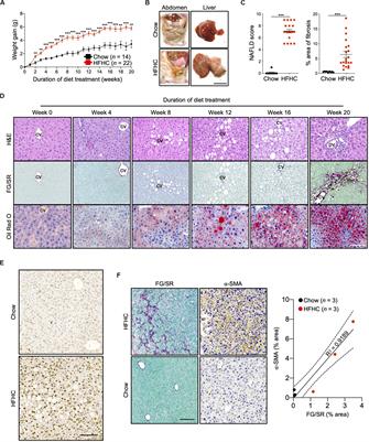 CD4+ T Cells Mediate the Development of Liver Fibrosis in High Fat Diet-Induced NAFLD in Humanized Mice